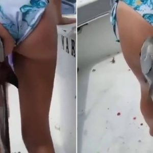 kadin-kalcasina-yapisan-vantuz-baligi