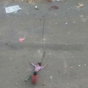 vurulan-kardesini-tasiyan