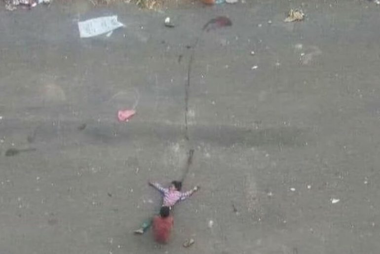 vurulan-kardesini-tasiyan