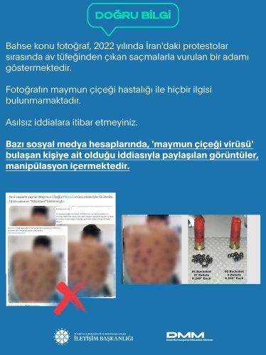 av-tufegi-sacmalariyla-vurulan