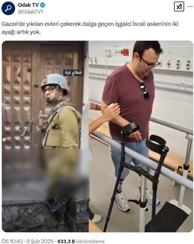 israil-askerinin-ayaklari-artik-yok