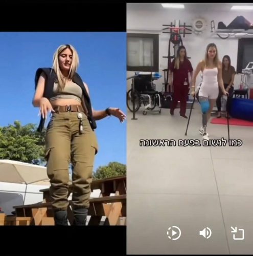 israil-kadin-asker-ampute