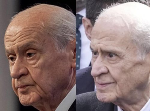bahceli-ameliyat-oncesi-sonrasi