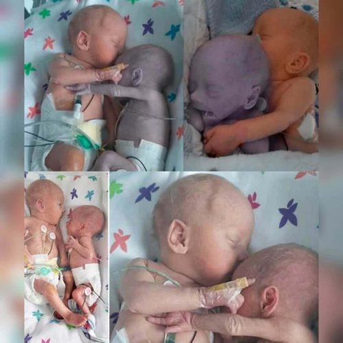 kardesine-sarilan-bebek