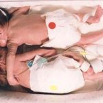 Erken Doğan İkizleri İyileştiren "Mucize Sarılma" sarilan-bebekler