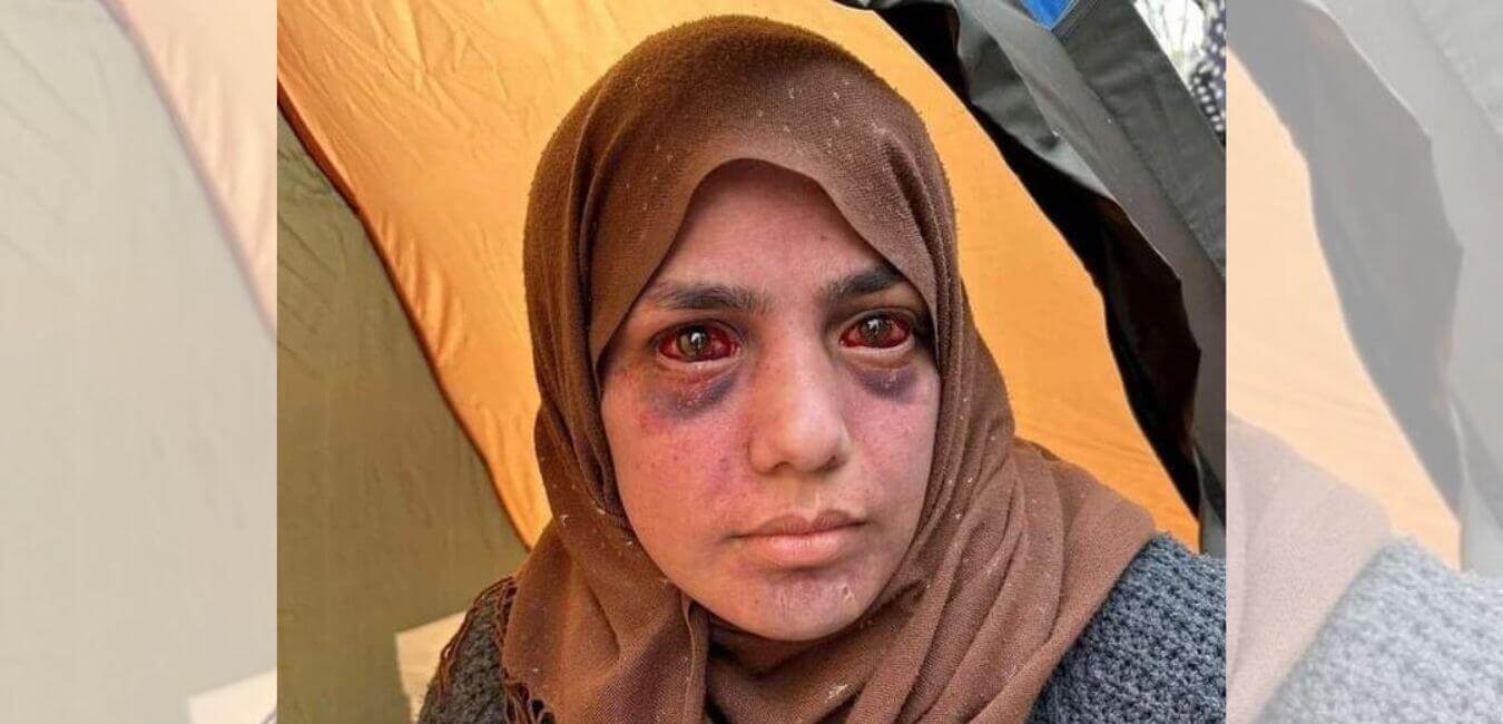 Gazze’de Kaydedildiği İddiasıyla Paylaşılan “Gözleri Kan Çanağına Dönmüş Kadın” Fotoğrafı gozleri-kan-aglamak