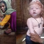 Hindistan'da Dünyaya Gelen Albino Bebeğin Tanrı Olarak Görüldüğü İddiası hindistan-albino-bebek