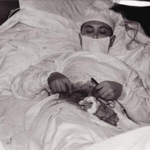 leonid rogozov kendi ameliyatini yaparken