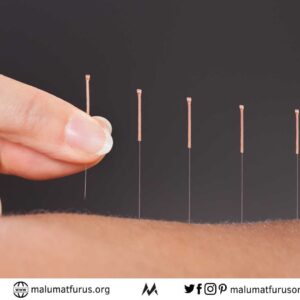akupunktur