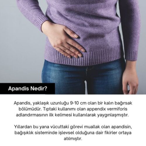 apandis nedir