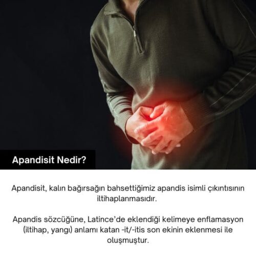 apandisit nedir