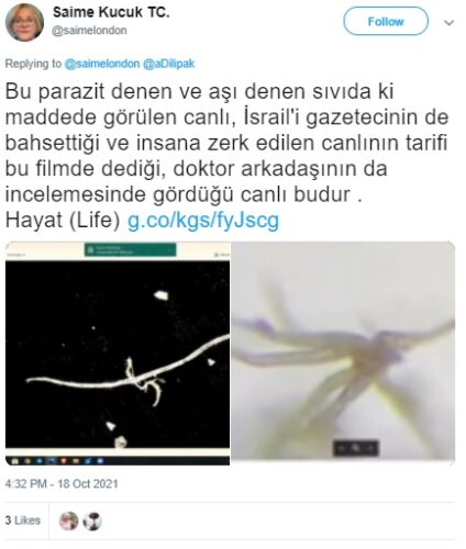 asi parazit canli