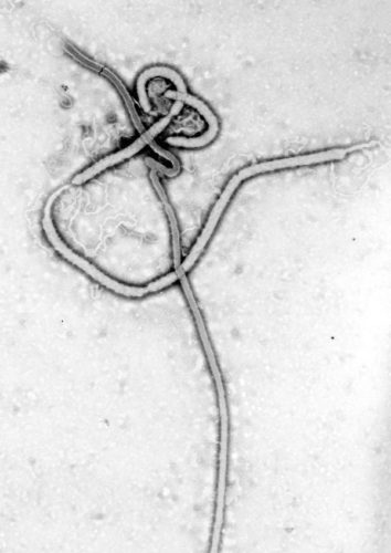 Ebola Virüsü