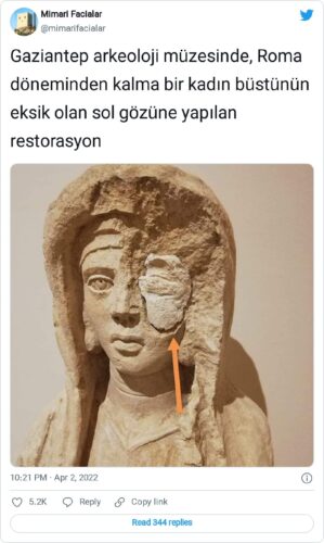 eksik olan goze dolgu restorasyon