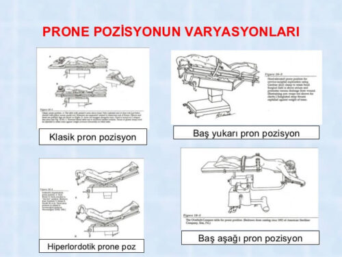 prone pozisyonunun çeşitleri