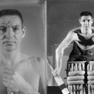 hokey kalecisi yüz yaraları