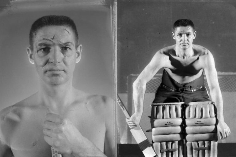 hokey kalecisi yüz yaraları