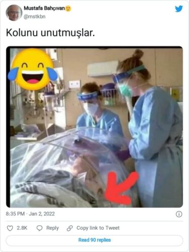 kolunu unutmuslar