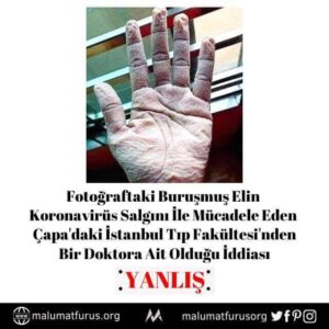 koronavirüs doktor el fotoğrafı