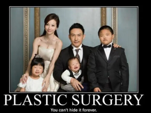 plastic surgery meme