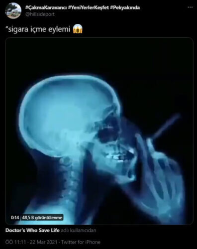 sigara-icme-xray