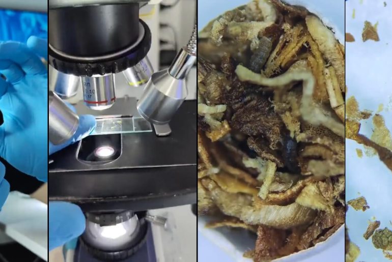 sigara-mikroskop-altinda