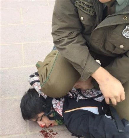 İsrailli Askerin Filistinli Genci İşkenceyle Öldürdüğü Andan Sanılan Fotoğraf