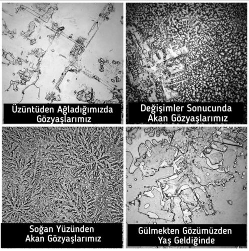 uzuntu degisim sogan gulme gozyasi