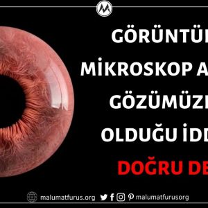 Videonun Mikroskop Altında Gözümüze Ait Olduğu İddiası Doğru Değil