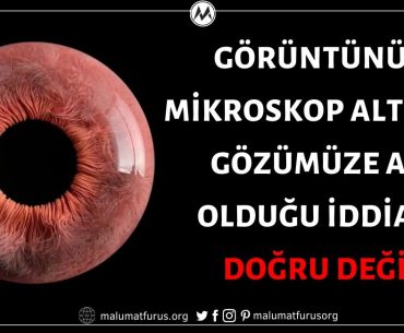 Videonun Mikroskop Altında Gözümüze Ait Olduğu İddiası Doğru Değil