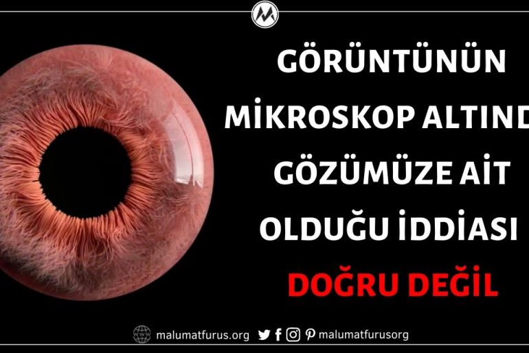 Videonun Mikroskop Altında Gözümüze Ait Olduğu İddiası Doğru Değil