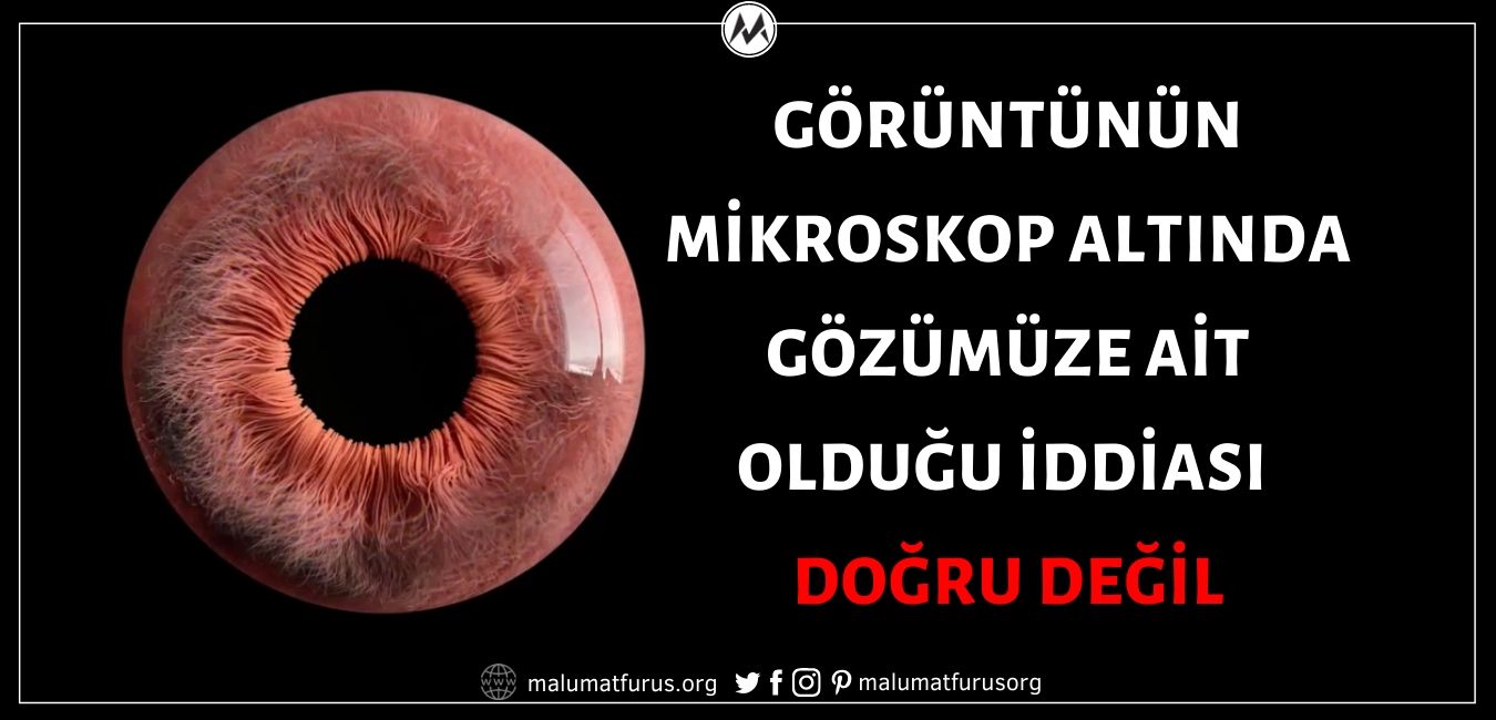 Videonun Mikroskop Altında Gözümüze Ait Olduğu İddiası Doğru Değil