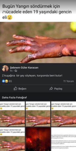 yangını söndürmek için mücadele eden gencin eli