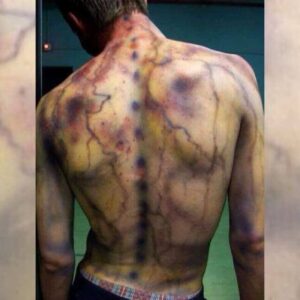 yildirim-carpmis-insan